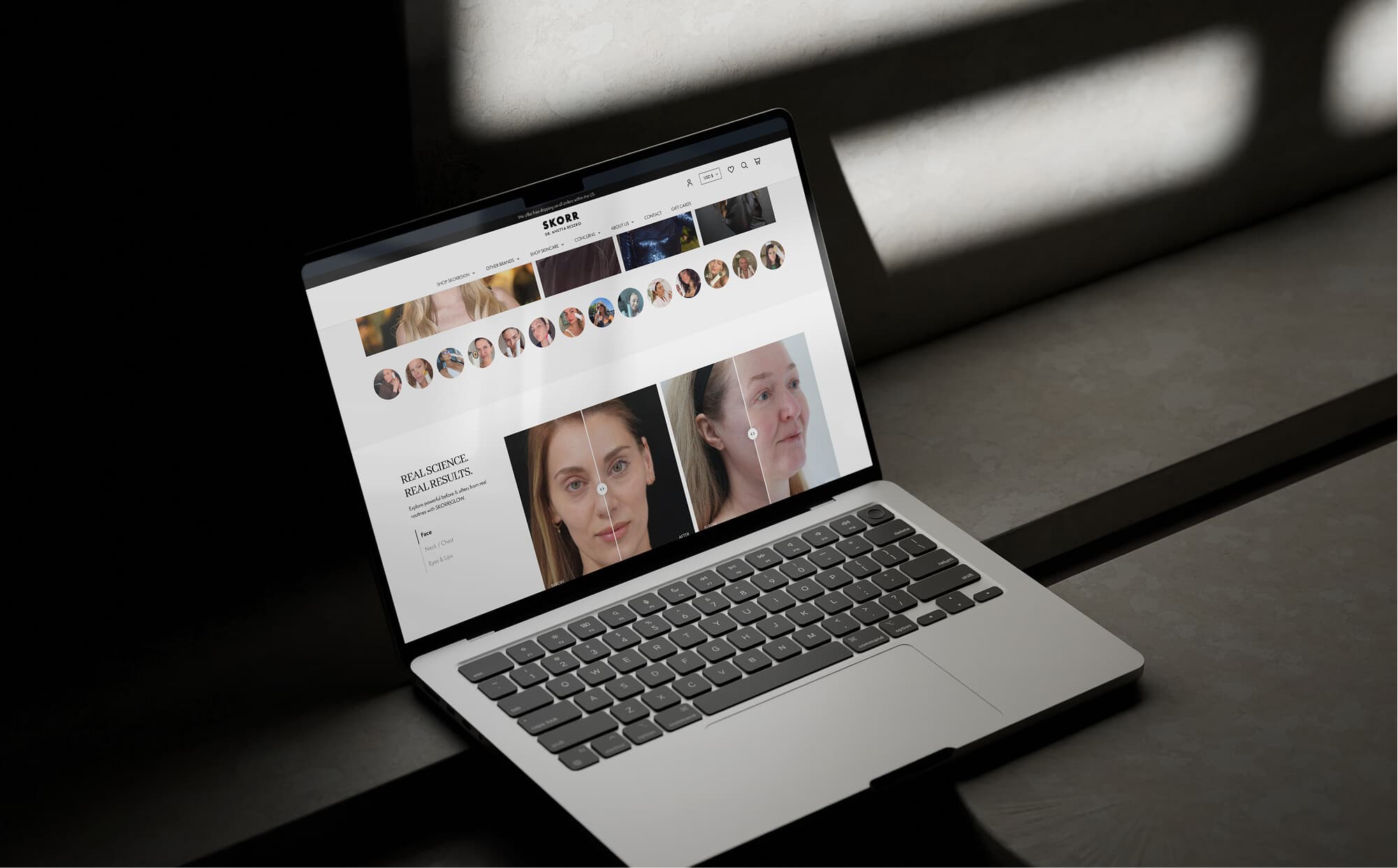 img-casestudy-skorr-01